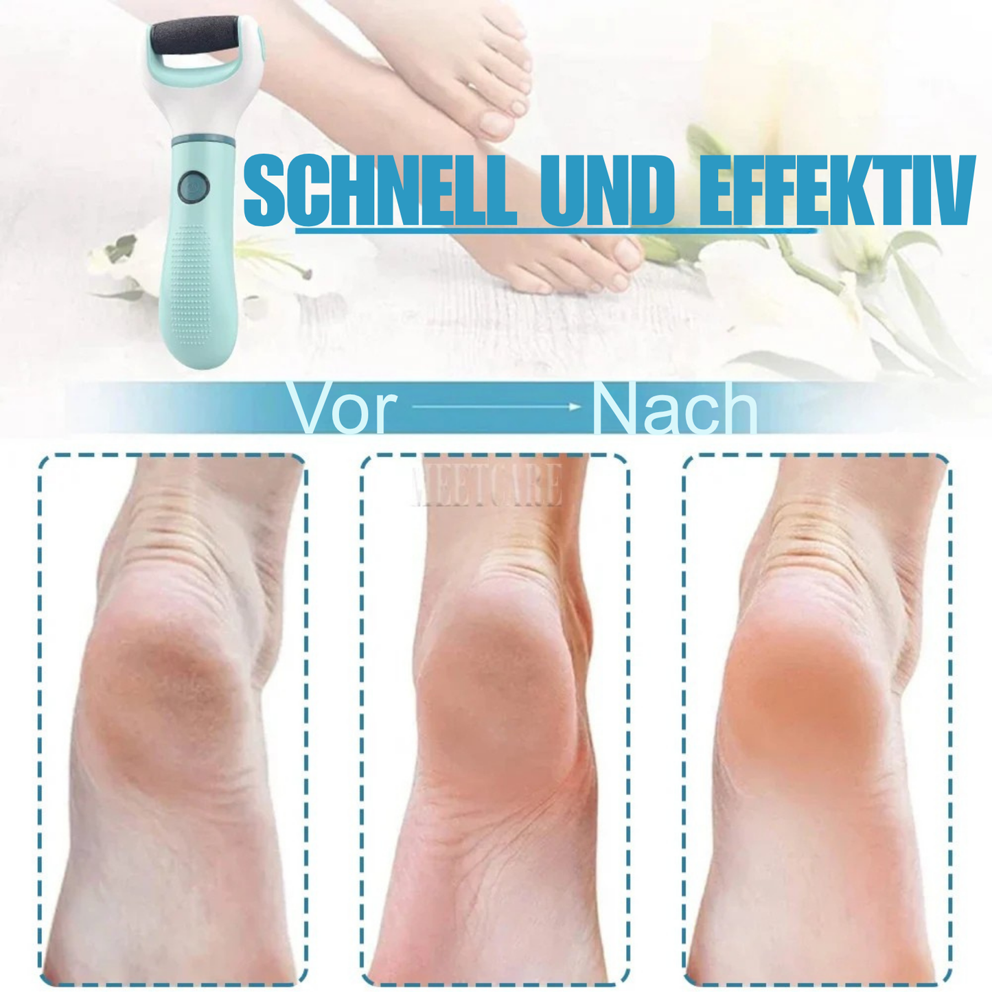 Ponceuse électrique pour les pieds, pour éliminer les peaux mortes, les callosités, les peaux craquelées.